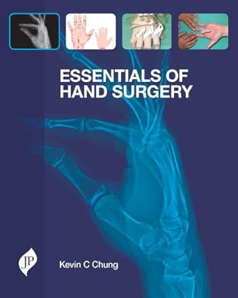 Essentials Of Hand Surgery