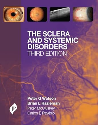The Sclera And Systemic Disorders