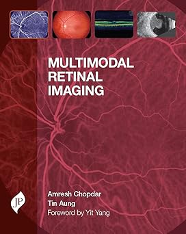 Multimodal Retinal Imaging